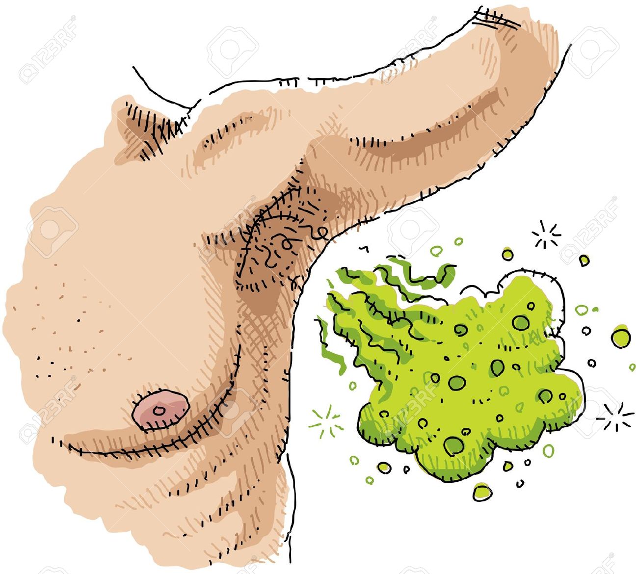 21035459 A cartoon of a man s smelly armpit Stock Photo body