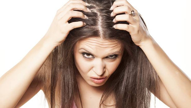 201607200711057887 Natural ways to prevent women from falling baldness SECVPF