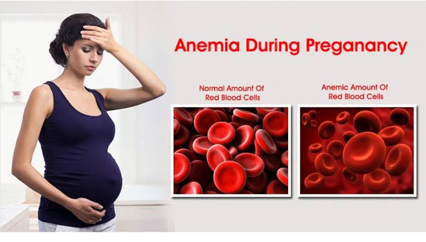 201609031319199584 Tips to prevent anemia during pregnancy SECVPF