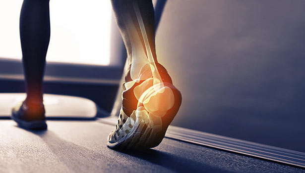 201702011350100091 ankle pain reason solutions SECVPF