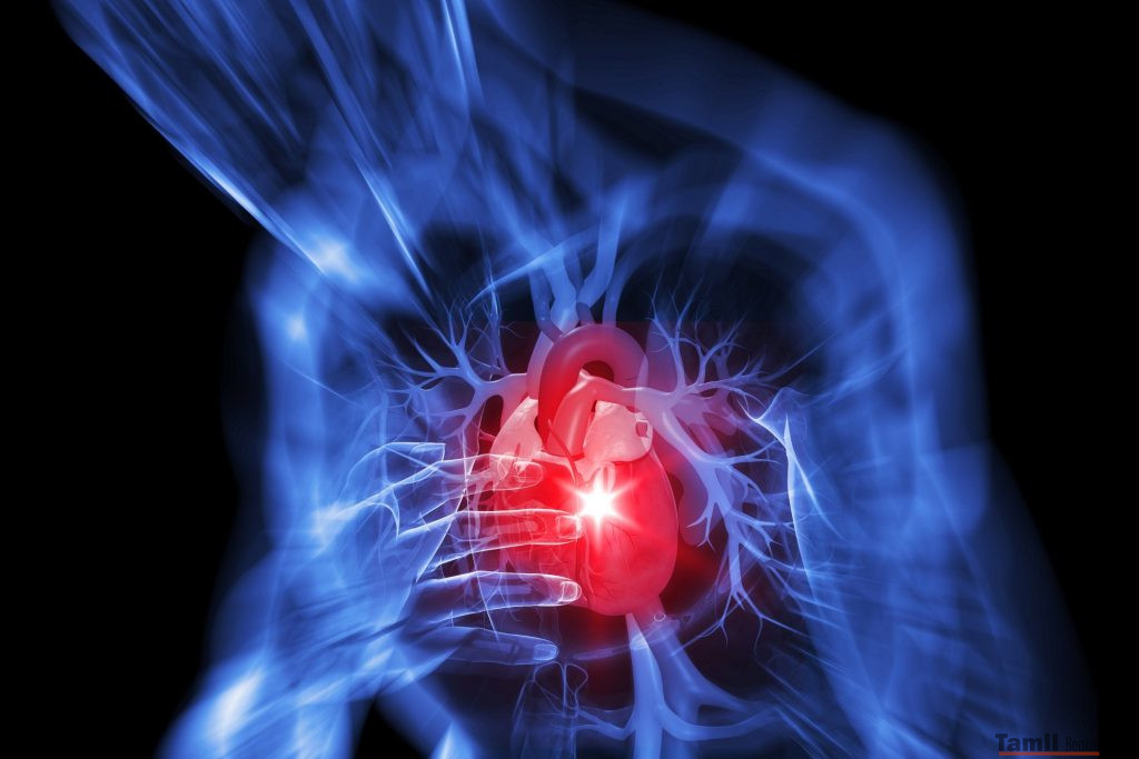 stylized heart attack angina 0