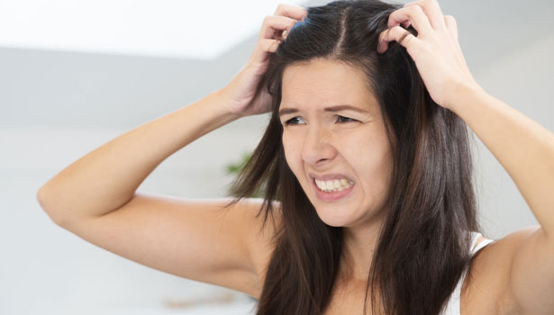 201608201042526165 Head itching hair dryness beauty tips SECVPF