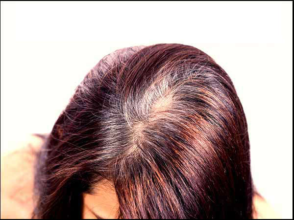 09 1470720917 3 unique tricks to get rid of grey hair