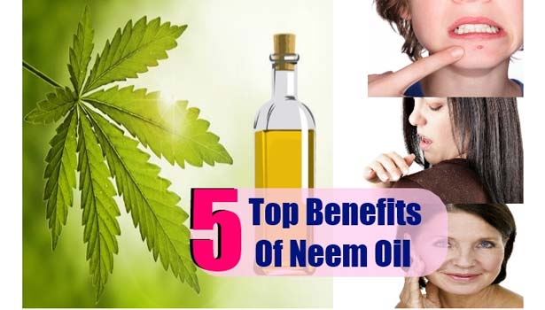 201612160925439475 Neem oil will provide the solution to the problems of the SECVPF