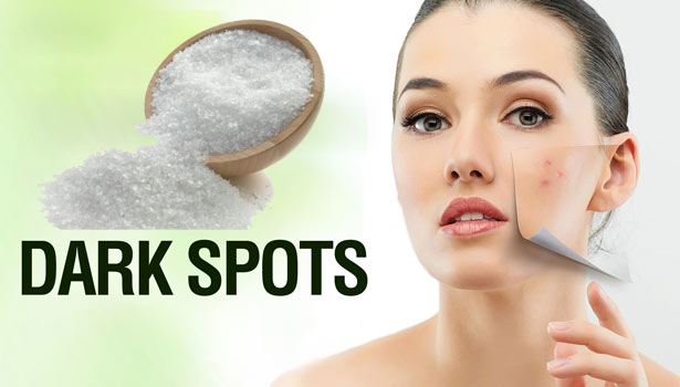 201612161003573485 How to clear the dark spots on the face with salt SECVPF