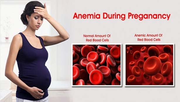 201702041202419521 anemia during pregnancy affect infant SECVPF