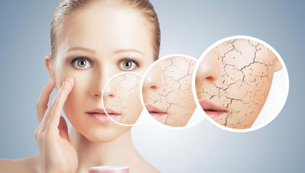 201702091000090263 7 ways to prevent skin dryness SECVPF