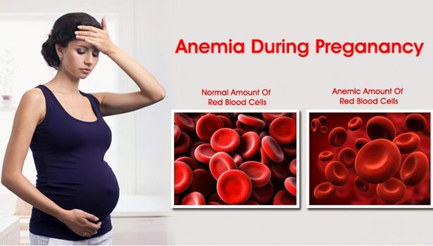 201707251352123845 Anemia during pregnancy affect the baby SECVPF