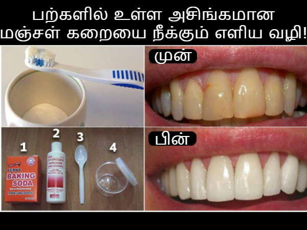 tooth care 08 1512719138