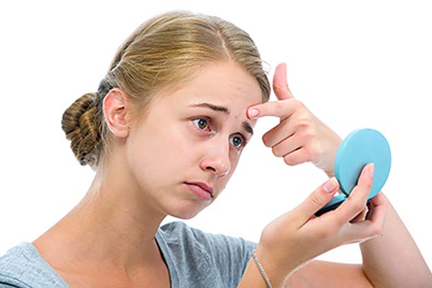 skincare tips for your teens 7 reasons to treat acne early