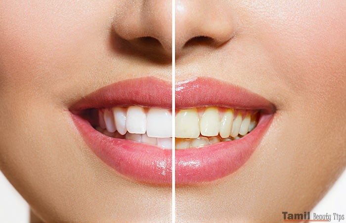 Effective Home Remedies To Get White Teeth