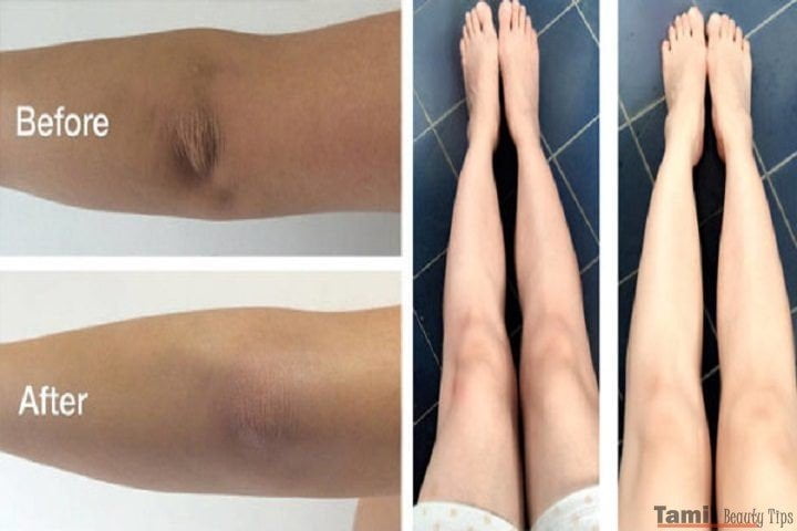 How To Get Rid Of Dark Knees And Elbows Naturally 600x300 e1471860877196