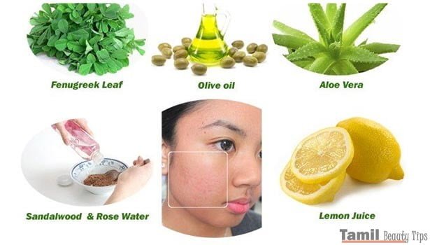 201807231045372530 1 Simple home remedies for pimples. L styvpf