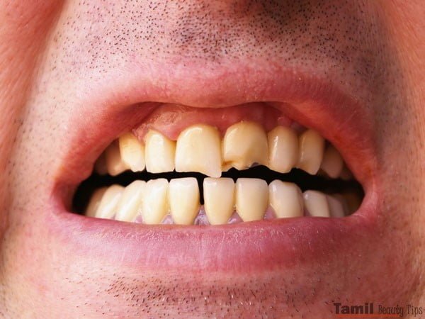 teeth4