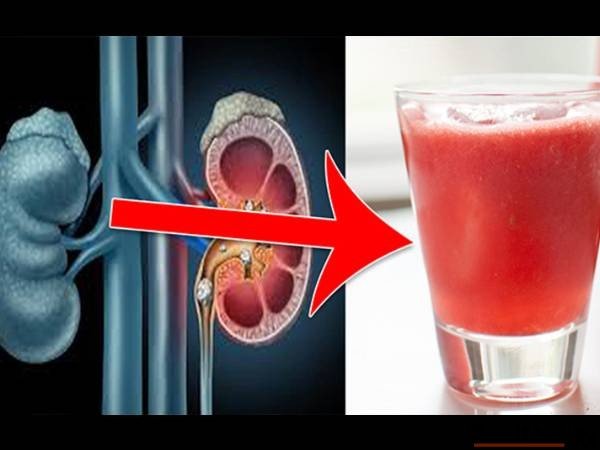 kidney juice 158