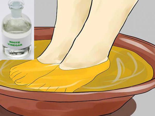 foot bath vinegar