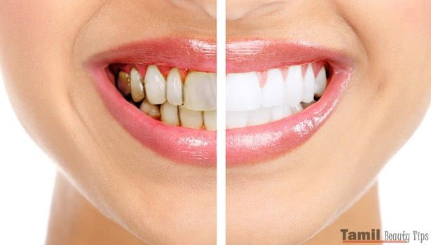 Home Remedies For Stains On Teeth