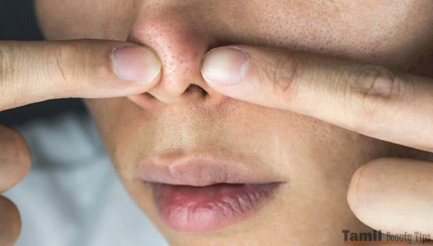 remove dark spots on Nose