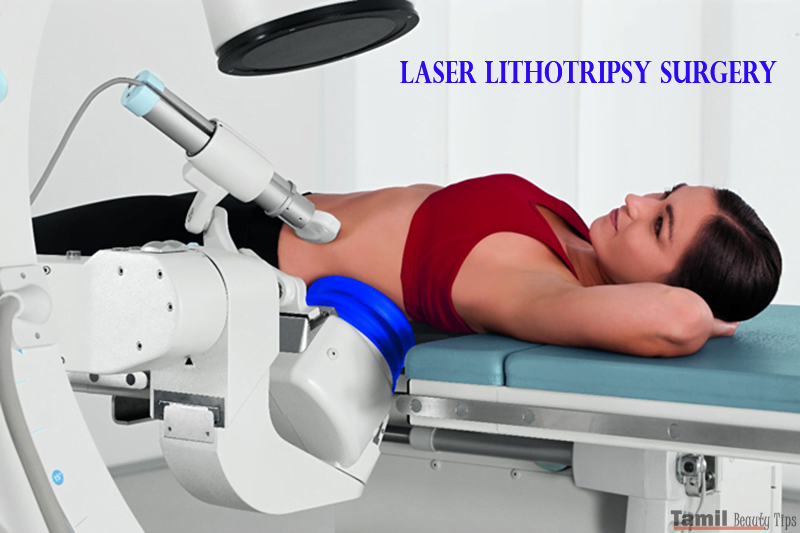 laser kidney stone surgery in pune
