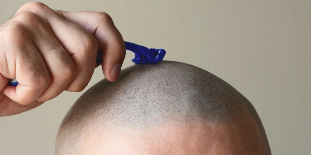 shaving head benefits